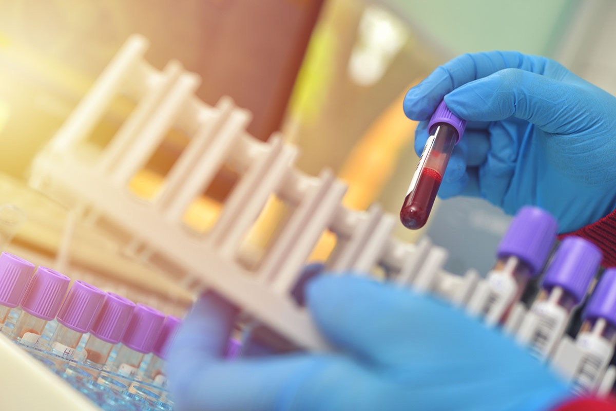 A gloved hand holding a blood sample tube above a rack of purple-capped collection tubes in a diagnostics laboratory