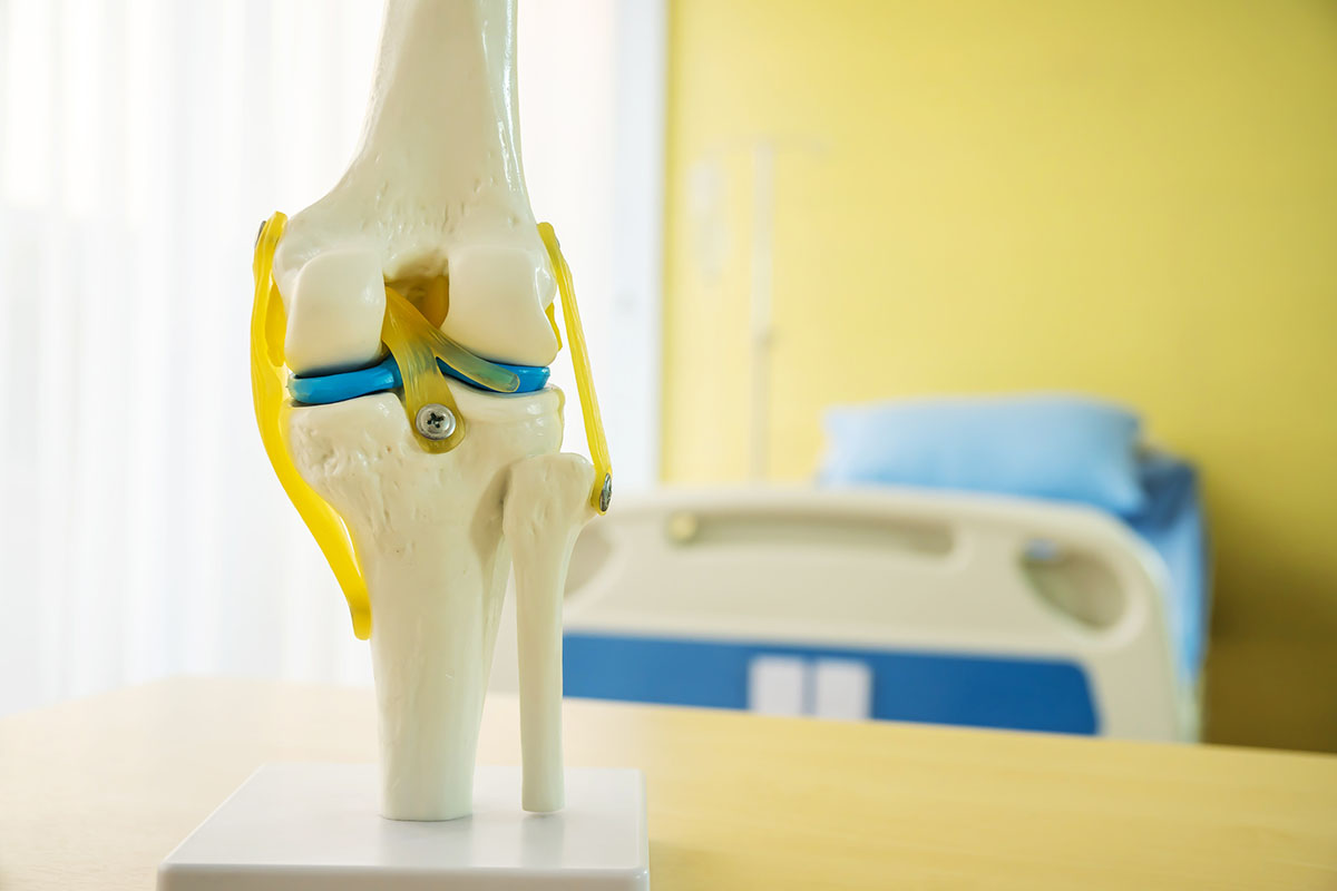 An anatomical model of a human knee joint on a wooden table, with an empty hospital bed softly out of focus against a yellow wall behind it